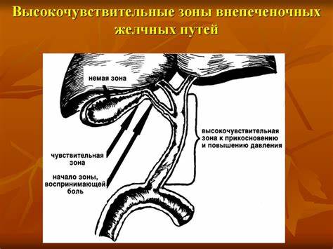 Что такое эндопротезирование желчных протоков - фото презентация Картинка - Что такое эндопротезирование желчных протоков - фото презентация