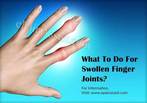 Swollen Finger Joints Osteoarthritis Arthritis