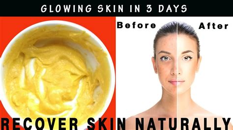 Get Fair Skin In Just 3 Days Skin Whitening Home Remedies By Care 4