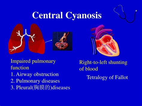 Ppt Physical Diagnosis Cyanosis Powerpoint Presentation Free