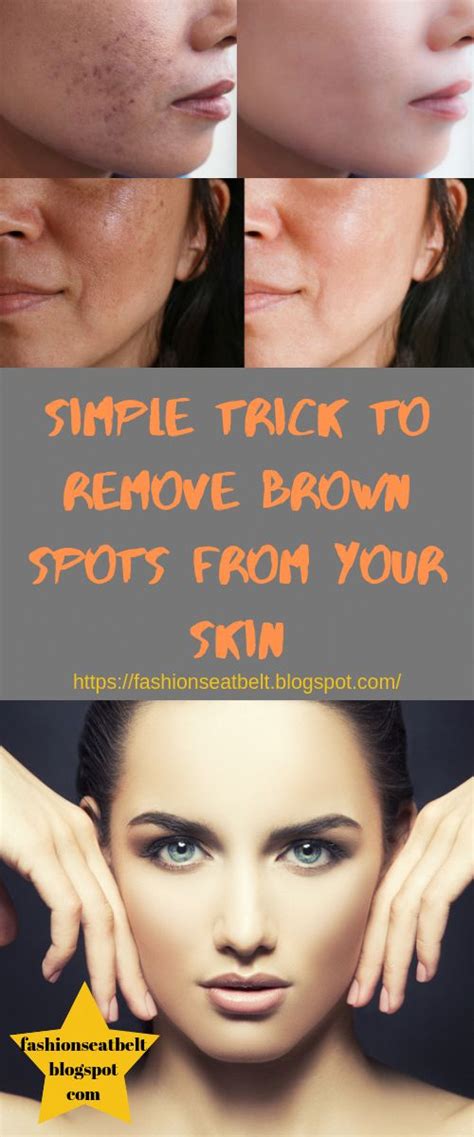Find Out Who Is Worried About Remove Brown Spots And Why You Should Pay Attention Healthy