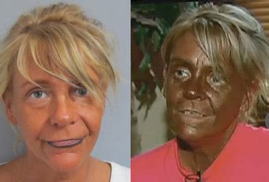 N J Tanning Mom Appears In New TV Interviews Much Darker Than Her