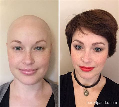 30 Incredible Before And After Pics Of People Who Beat Cancer That Will