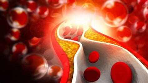 Can Cholesterol Drugs Kill Prostate Cancer Cells Dr David Samadi