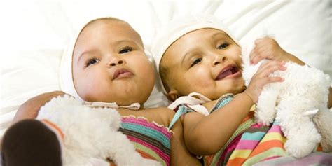 Surgeons Successfully Separate Very Rare Conjoined Twins Fox News