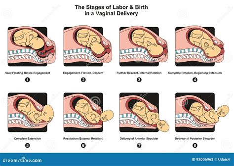 Stages Of Labor And Birth In A Vaginal Delivery Stock Vector