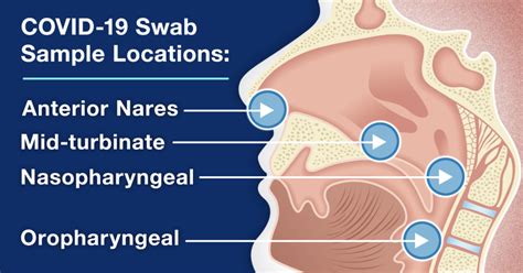 Should You Swab Your Throat At Home For Covid 19