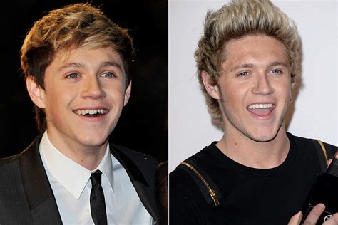 celebrities teeth transformations before and after [photos]