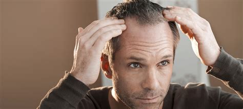 Hair loss may include skin changes or bald spots. How To Make Thinning Hair Look Thicker | FashionBeans