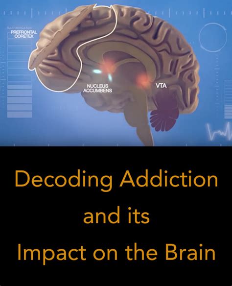 How Science Is Decoding Addiction And Its Impact On The Brain Inspire