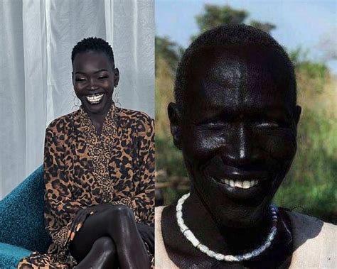Darkest Skinned Man In The World