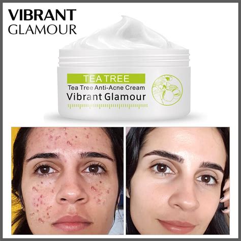 Vibrant Glamour Tea Tree Acne Eliminating Face Cream Remove Acne Scar