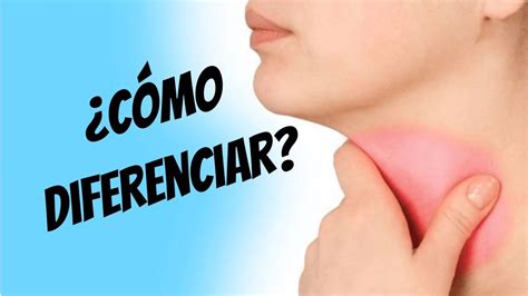 Como Diferenciar Una Faringitis Viral Y Bacteriana Estreptococo Beta