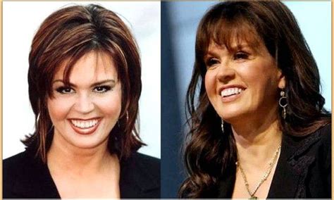 Marie Osmond Plastic Surgery Before And After Effects With Images