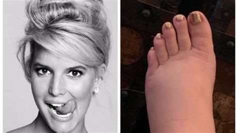 Jessica Simpson Welcomes Sight Of Her Postpregnancy Ankles
