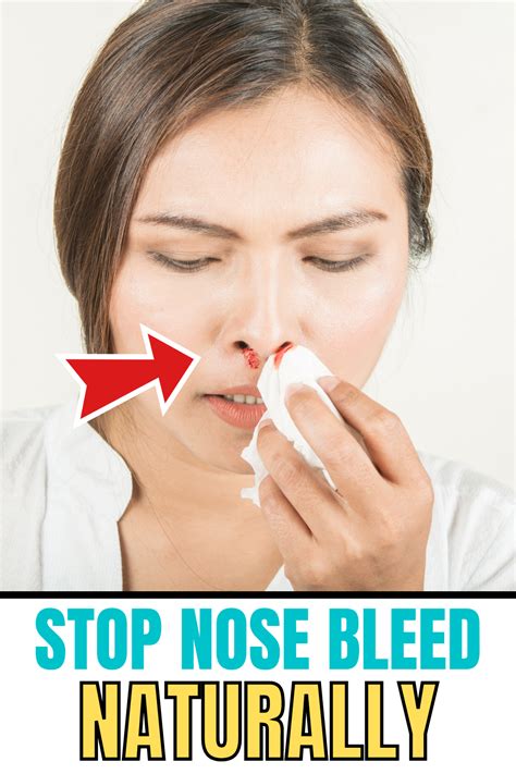 9 Effective Home Remedies To Stop Nose Bleeding In 2021 Stop Nose Bleeds Nose Bleeds Nose