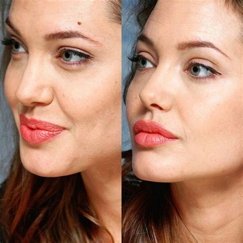 Angelina Jolie Nose Angelina Jolie Plastic Surgery Rynoplasty Before  In