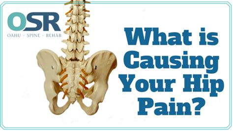 What Is Causing Your Hip Pain