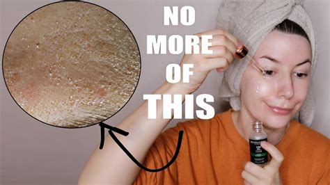10 Things That Will Help Your Dehydrated Skin Youtube