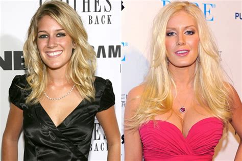 Celebrities Plastic Surgery See Before And After Photos