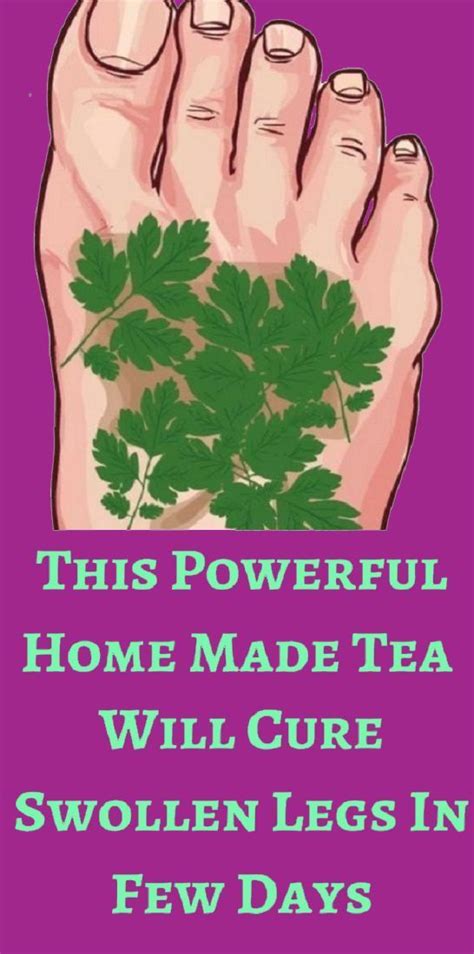 This Tea Is The Ultimate Remedy For Swollen Feet With Images How