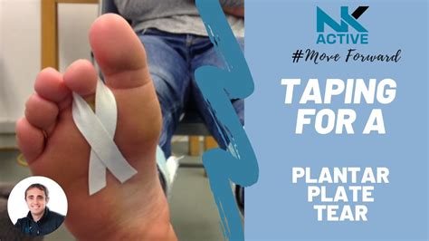 Taping For A Plantar Plate Injury Tear Treatment Injuries Youtube