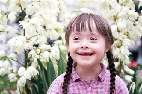 Yuk Mengenal 4 Macam Kelainan Trisomi Down Syndrome Itu Salah Satunya