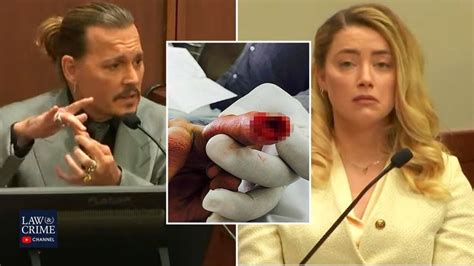 Amber Heard Allegedly Threw Glass Bottle At Johnny Depp That Severed