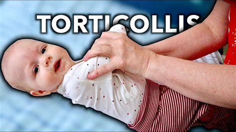 4 Month Old With Torticollis Treated By Massage Therapist Youtube