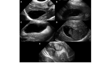 Representative Ultrasound Images Of The Gallbladder Gb In Dogs With