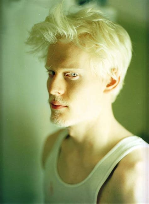 Pinterest Albino Model Albino Men Stephen Thompson