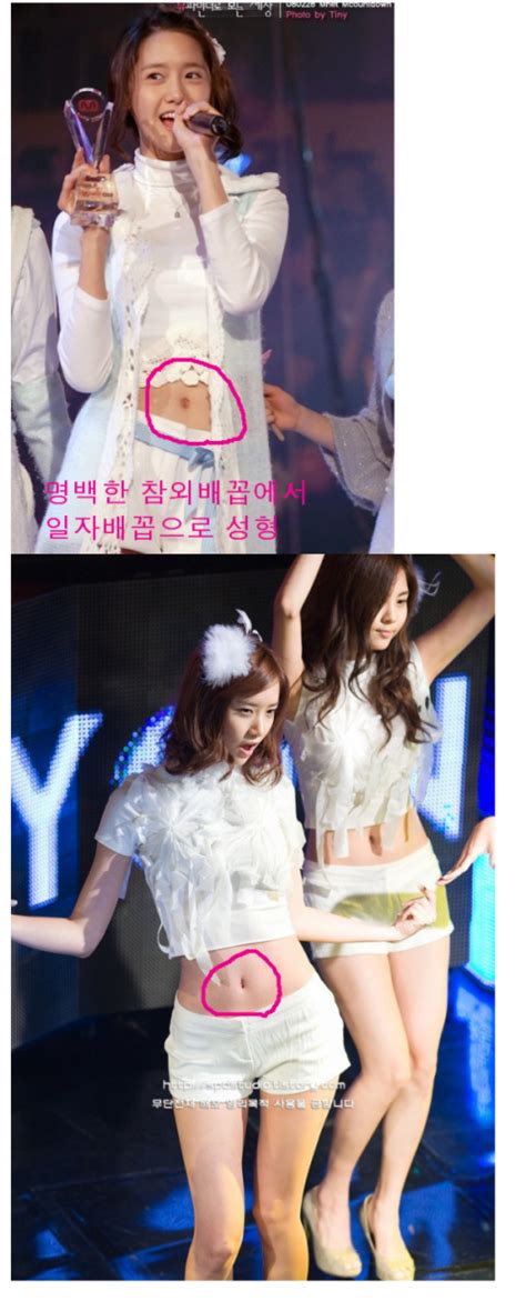 [news] Snsd Yoona Had A Plastic Surgery Daily K Pop News Latest K Pop News