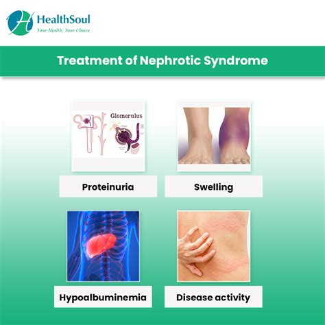 Nephrotic Syndrome Symptoms And Treatment Nephrology Healthsoul