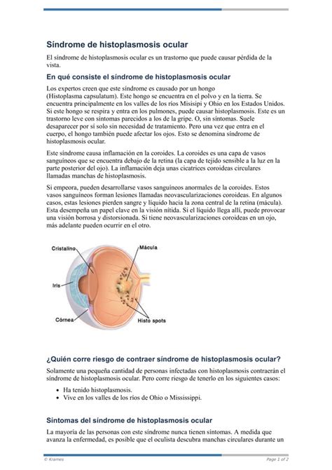 Text Síndrome de histoplasmosis ocular HealthClips Online