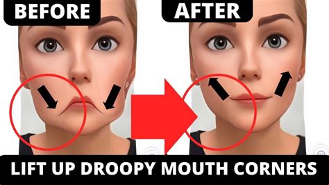 How To Lift Up Droopy Mouth Corners Effective Exercises How To Lift Up Lips Corners Youtube