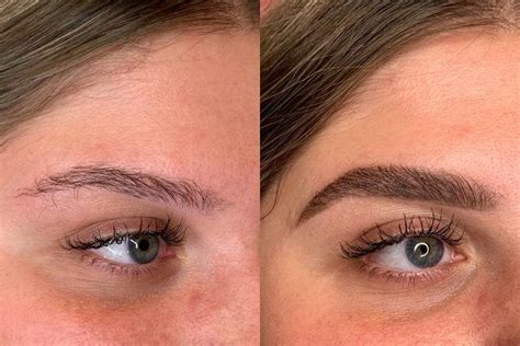 5 Eyebrow Before And After Transformations That Prove Any Brow Can Be Easily Saved Bad