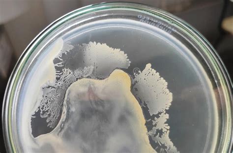 Bacillus Genus Bacteria Colonies Stock Image Image Of Microorganisms
