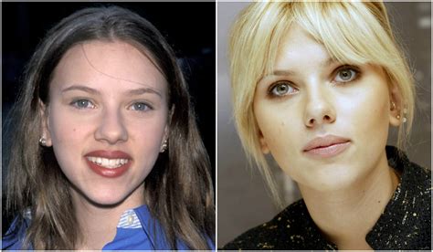 20 celebridades antes y después de operarse la nariz