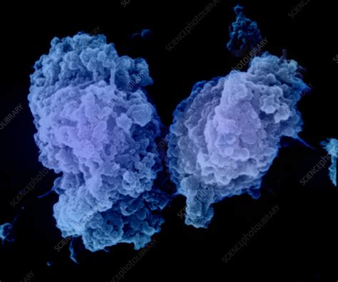 Apoptosis Of A Lymphocyte Stock Image C0093536 Science Photo Library