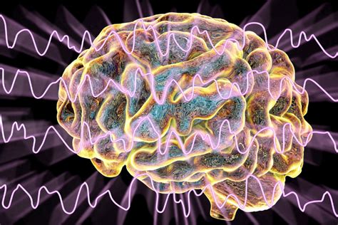 Wah Ternyata 5 Fakta Unik Tentang Otak Yang Harus Manusia Ketahui