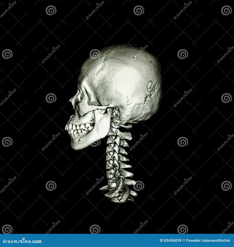 Ct Scan With 3d Image Of Normal Human Skull And Cervical Spine Lateral