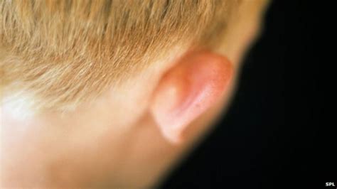 Great Ormond Street Doctors Aim To Grow Ears From Fat Bbc News