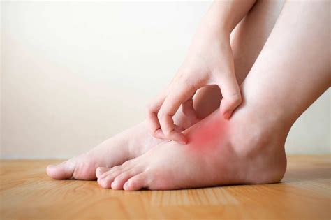 Diabetic Foot Rash Symptoms And Treatment Fresno And Visalia Podiatry