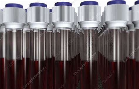 Multiple Blood Sample Tubes Stock Image C0080223 Science Photo