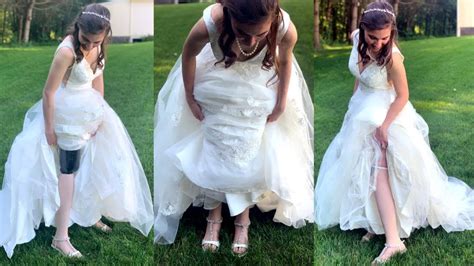 Why Double Amputee Wore Dress For 1st Time Ever At Wedding Youtube
