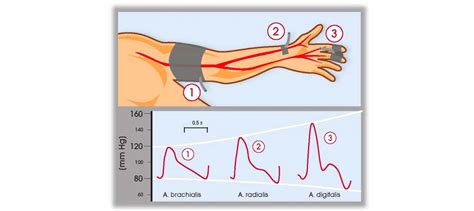 Radial Artery Anatomy Location Pulse Pathology Learn From Doctor