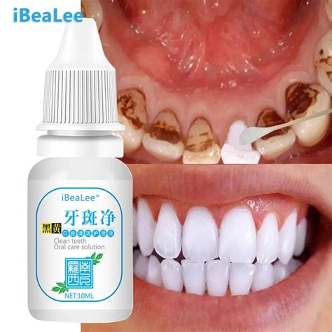 Teeth Whitening Essence Powder Clean Oral Hygiene Whiten Teeth Remove