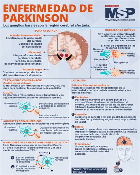 Infografía Sobre La Enfermedad De Parkinson Actualfarma