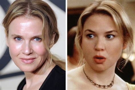 Renée Zellweger, Plastic Surgery, & Loving My Aging Skin ...