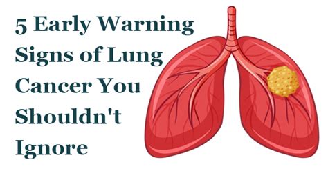 Sign And Symptom Of Lung Cancer Lung Cancer Signs And Symptoms Roy